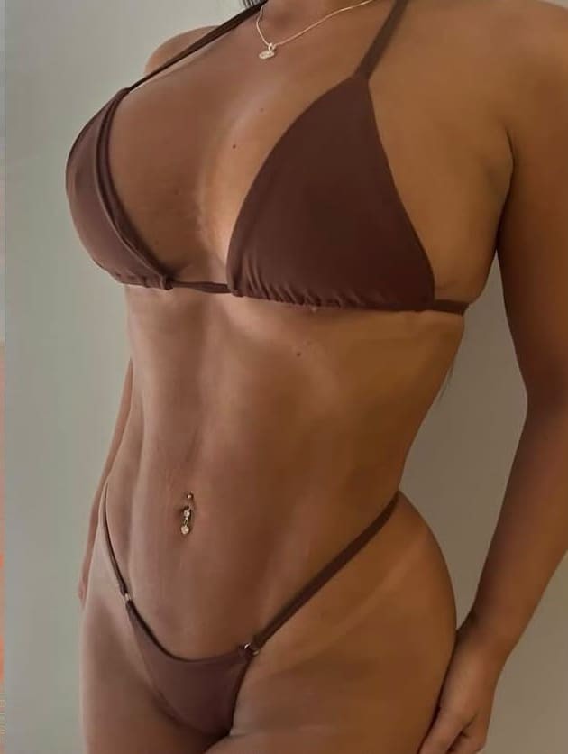 Depois — Abdominoplastia