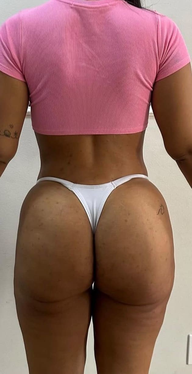 Depois — Glúteo